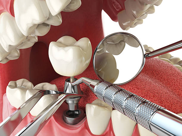 Best Emergency Broken Tooth Repair in Ferrysburg, MI